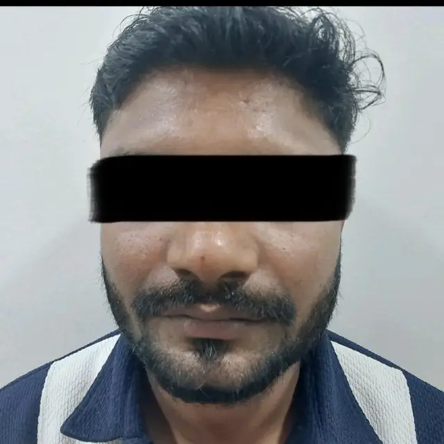 Hair Thinning Treatment in Kothrud