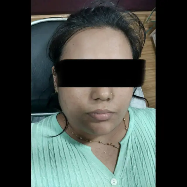 Lip Specialist in Kothrud