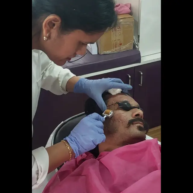 Laser Skin Treatment in Kothrud