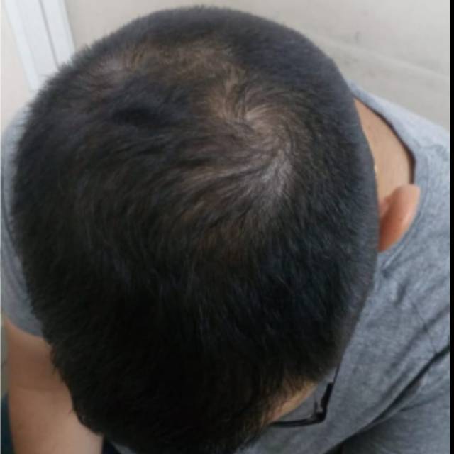 Hair Doctor in Kothrud
