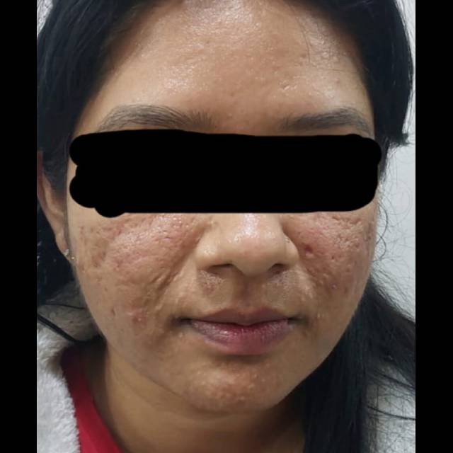Experienced Skin Specialist in Kothrud