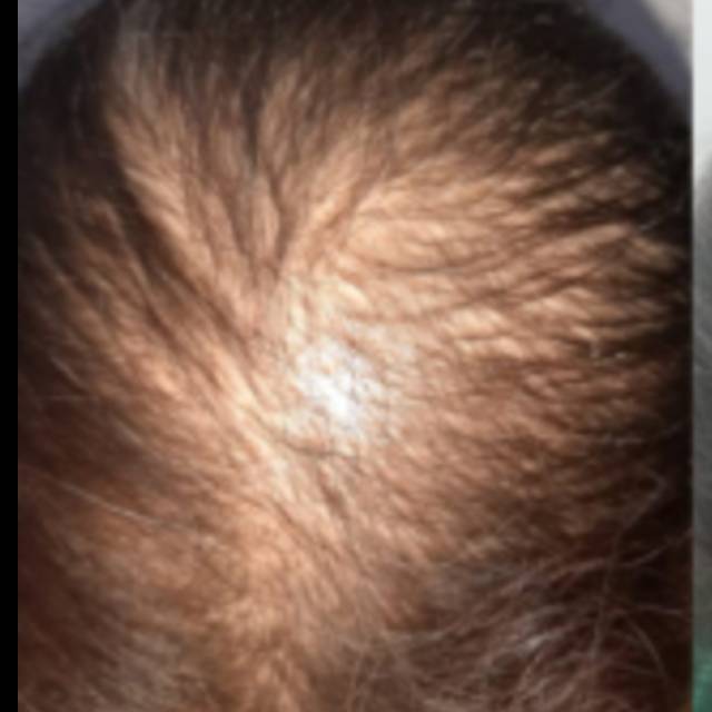 Hair Specialist in Kothrud