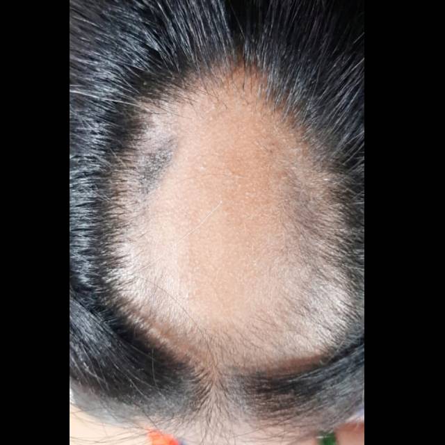Best Hair Doctor near me in Kothrud