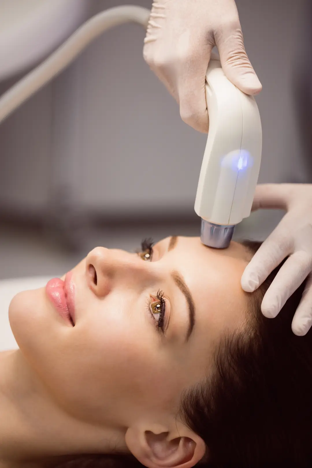 Laser Treatment for Pigmentation in Kothrud