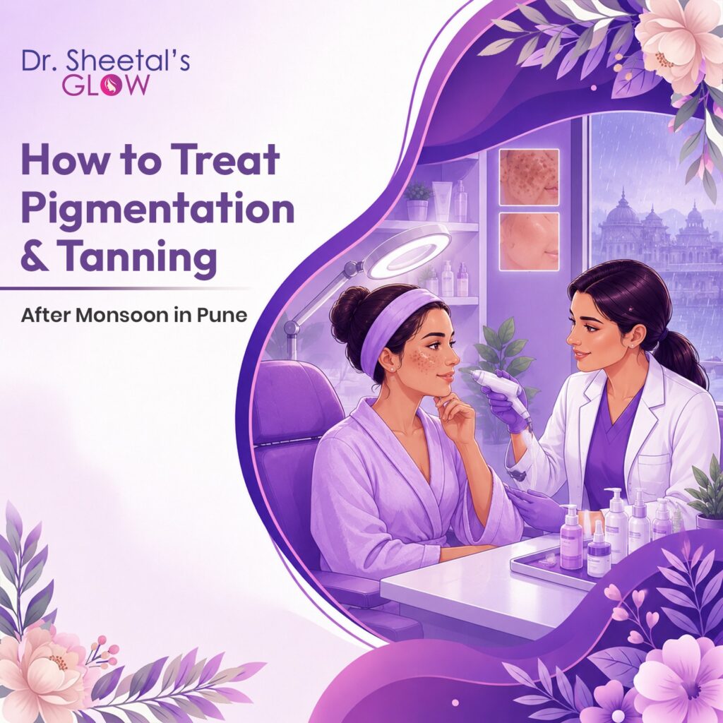 Pigmentation & Tanning Treatment in Kothrud, Pune